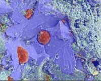 Ductile cast iron fracture with X-ray map overlay
