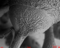 Unidentified bug' face . No gold sputtering was used.