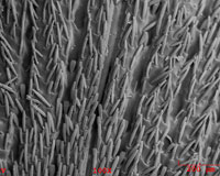 Unidentified bug's head. No gold sputtering was used.