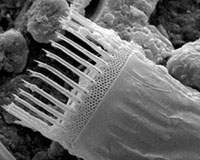 Skeletonema Costatum, tentacles used to attach to others to form chain.