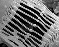 Close up of two Skeletonema Costatum attaching to each other.