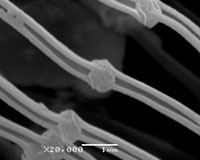 Magnification of tentacle attachement